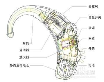 助聽(tīng)器的(de)工作原理(lǐ)